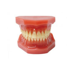 TM-B6 Orthodontic Model After Orthodontic Treatment